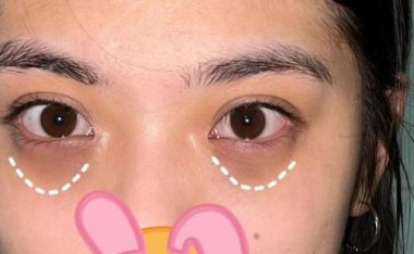 狐狸单挑土狗出装攻略(狐狸如何战胜土狗?)