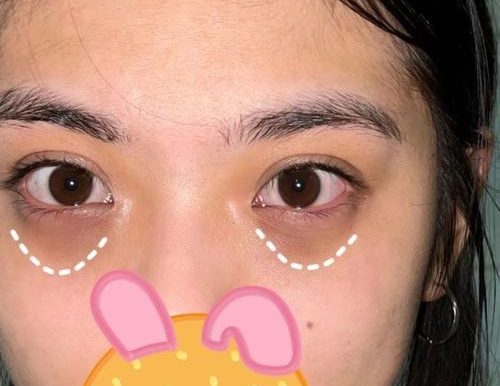 狐狸单挑土狗出装攻略(狐狸如何战胜土狗?)